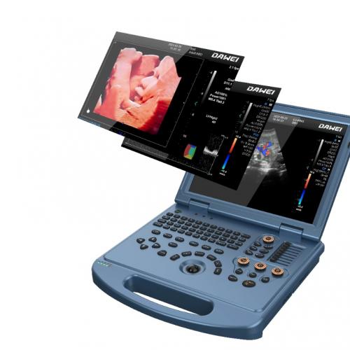 DW-50L 4D D-Live Light And Handy Color Ultrasound Apparatus